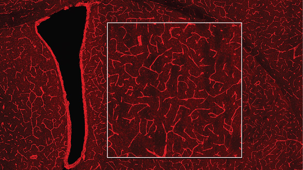 A MRI image of a brain shows bright red blood vessels on a darker red background.